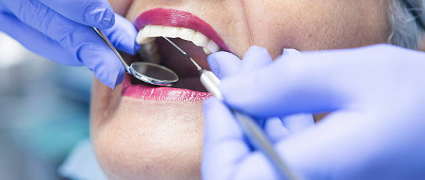Best Walk-In Emergency Dentist in Mino Tassajara, CA